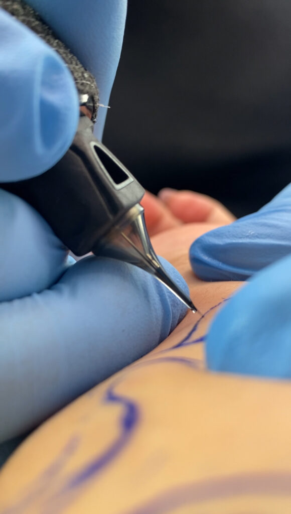 Tatuagem sendo realizada em pele humana